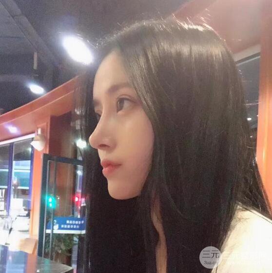 膨體隆鼻和雙眼皮一起做的果怎么樣？