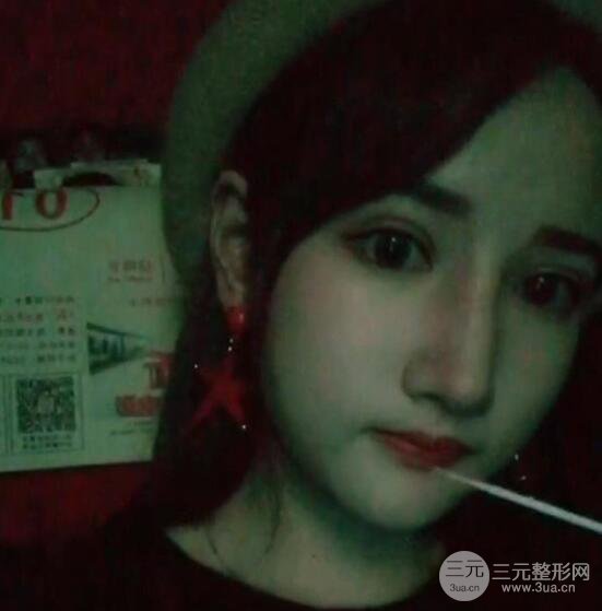 去下頜角+顴骨內(nèi)推手術(shù)三個(gè)月記錄，看大臉妹如何逆襲