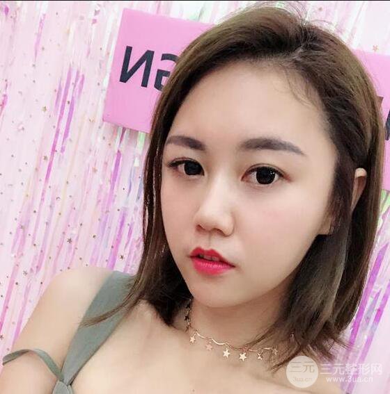 泉州億星閔英俊磨骨恢復(fù)圖分享