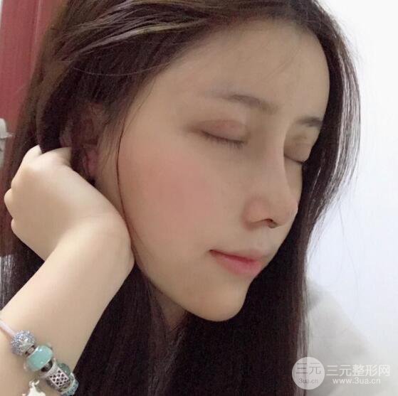 膨體隆鼻和雙眼皮一起做的果怎么樣？