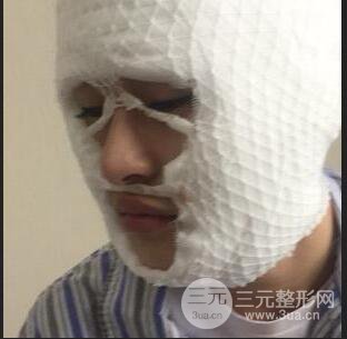 河南中醫(yī)藥大學(xué)第(一)附屬醫(yī)院趙絳波做磨骨怎么樣？看看這位小姐姐的蛻變叭！