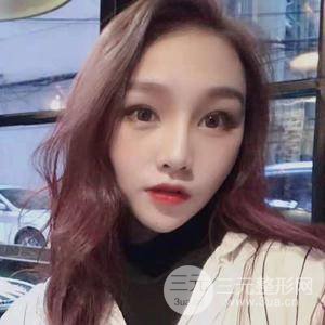 膨體大綜合隆鼻手術(shù)恢復(fù)過程圖附對比照