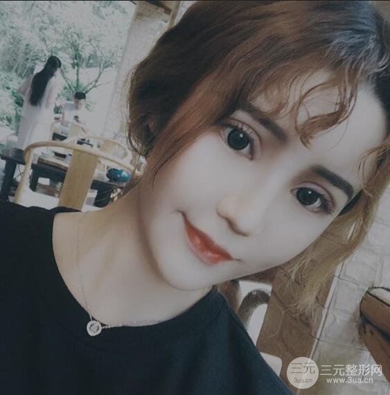 原來我和baby的距離只差一個網(wǎng)紅套餐，“雙眼皮+自體脂肪填充+豐唇”術(shù)后真人反饋