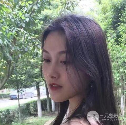 做了“埋埋蛋白線.提升+隆鼻整形”，恢復(fù)后老公說很沒有降低風(fēng)險(xiǎn)感