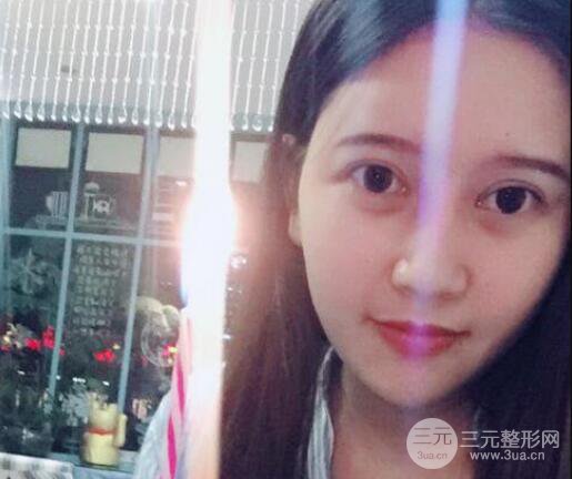 宜昌美岸醫(yī)療美容李英華自體脂肪面部填充怎么樣？真人日記曝光