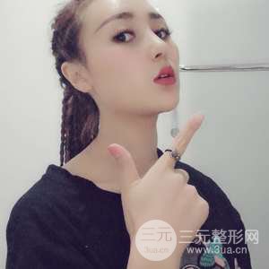 進(jìn)口假體+肋軟骨墊鼻尖三個(gè)月果恢復(fù)對(duì)比圖