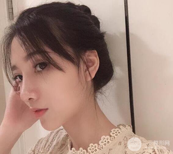 隆鼻整形手術三個月后真人果圖