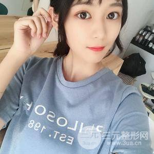 肋軟骨隆鼻果對比圖