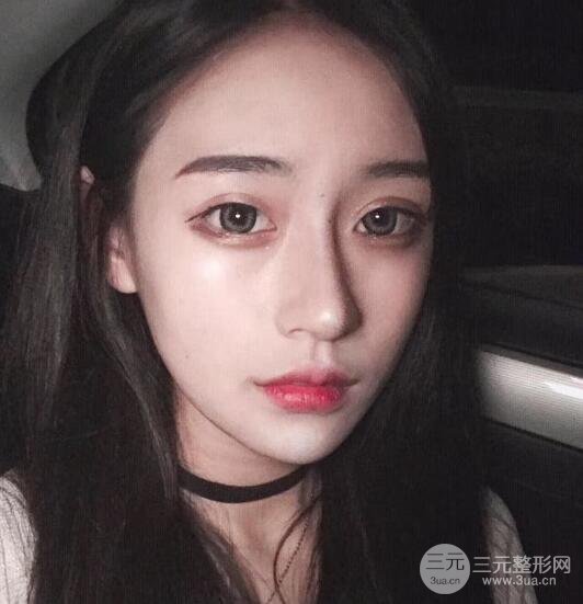 河南中醫(yī)藥大學(xué)第(一)附屬醫(yī)院趙絳波做磨骨怎么樣？看看這位小姐姐的蛻變叭！