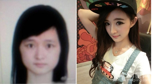 陳丹婷整容前舊照曝光,整形前后對比圖