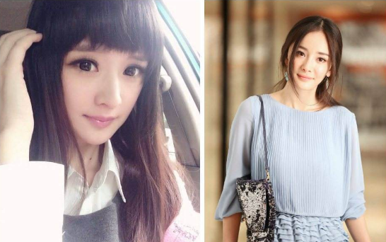 眼睛整形手術(shù)，陳丹婷整容前舊照曝光