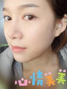 光子嫩膚 我的皮膚也可以白皙Q彈啦~