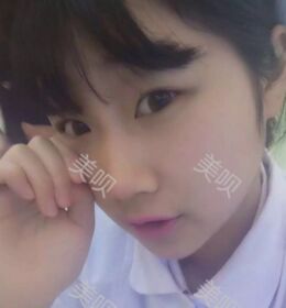 做了切開雙眼皮之后氣質(zhì)都不一樣了