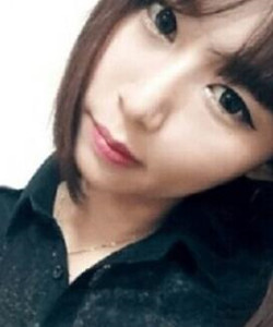 去北京301醫(yī)院整形美容科做了顴骨內(nèi)推大家快來(lái)圍觀啦