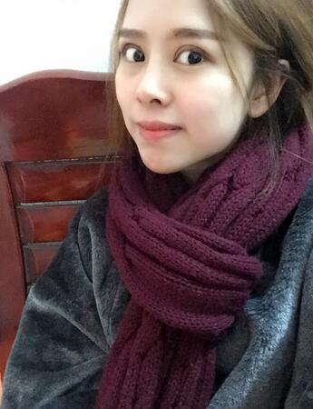 切開雙眼皮恢復(fù)過程 心路分享~