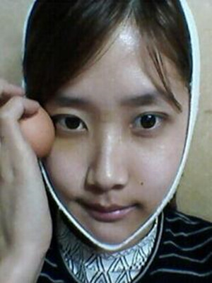 終于做了下頜角磨骨的手術(shù) 北京藝星做的 果還不錯