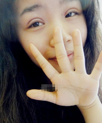 你們來看看藝美門智和做的埋線雙眼皮，瞬間變大眼美女