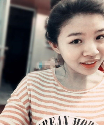 你們來看看藝美門智和做的埋線雙眼皮，瞬間變大眼美女