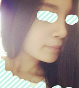 藝美門智和綜合隆鼻，你值得擁有