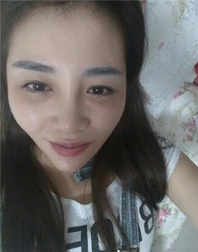 來評(píng)價(jià)一下華美劉琦做的高強(qiáng)度聚焦超聲吧