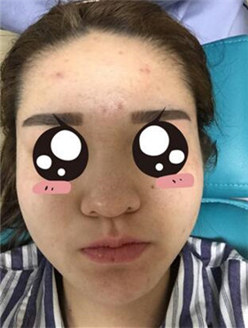 杜姜給我打了水光補(bǔ)水看起來(lái)皮膚嫩嫩的