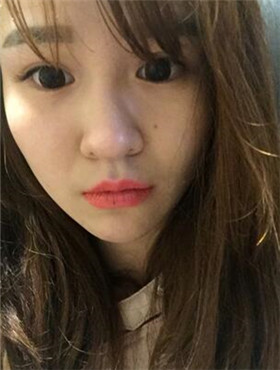 杜姜給我打了水光補(bǔ)水看起來(lái)皮膚嫩嫩的