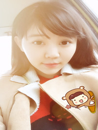 開(kāi)外眼角手術(shù)前后過(guò)程對(duì)比圖片