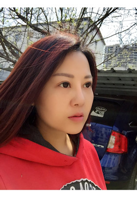 自體脂肪填充面部前后對比圖片，真的美了美了!