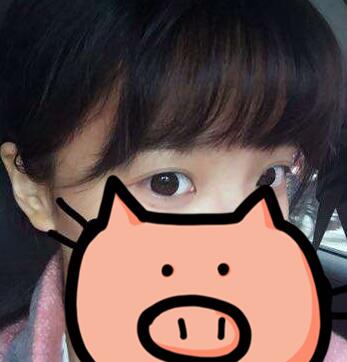 成都玉之光發(fā)際線種植 果不錯~