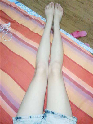 去年東方和諧張準醫(yī)生做的大腿抽脂，分享一下我的前后對比果圖片！