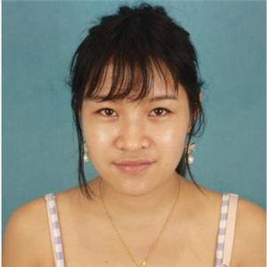 在米揚(yáng)麗格做的自體軟骨隆鼻，巫文云院長(zhǎng)的技術(shù)棒棒噠！