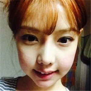 米揚(yáng)麗格夏正義做雙眼皮果怎么樣？看看我的前后對比果圖片吧！