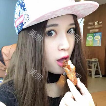 在成都藝美匯做的切開雙眼皮+開眼角果還可以吧