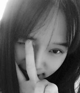 全切雙眼皮+去脂肪，終于擺脫小眼睛了