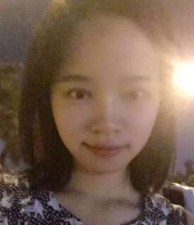 全切雙眼皮+去脂肪，終于擺脫小眼睛了