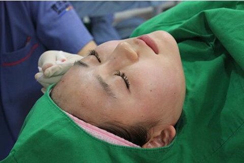 我做高強(qiáng)度聚焦超聲面b提升真實(shí)經(jīng)歷 繼續(xù)做我的少女