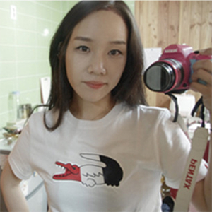 去年在格萊美做了頭發(fā)種植，看看前后對(duì)比和恢復(fù)果照片吧~~