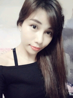 美萊鄧正輝做的切開雙眼皮 終于變美了