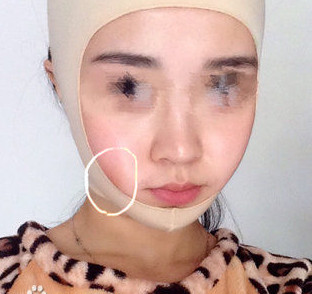 磨骨瘦臉后，終于擺脫大餅?zāi)樍耍? /> </a>
										<a href=