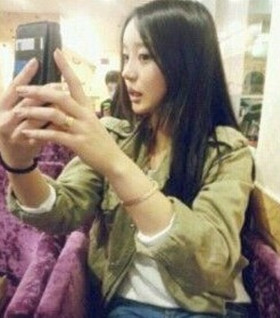 假體隆鼻手術(shù)過程前后對比圖片