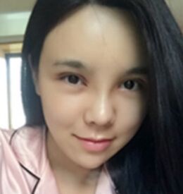 職業(yè)模特為變美下定決心做了隆鼻整形