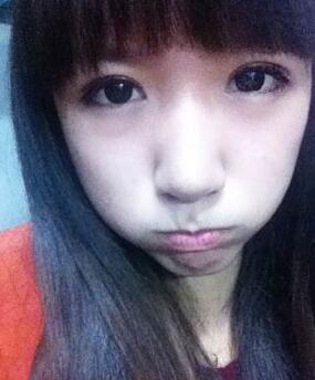 北京常好麗格三點定位雙眼皮恢復一個月經歷