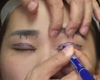 切開雙眼皮價(jià)格2680元，費(fèi)用不貴果卻很好