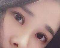 切開雙眼皮價(jià)格2680元，費(fèi)用不貴果卻很好