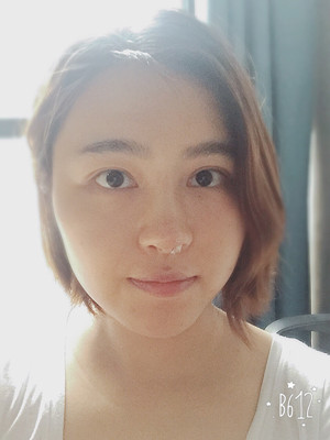 自體耳軟骨隆鼻后顏值上升了有沒有 莫琳娜葛紅做的