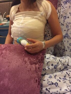 假體隆胸終于讓我擺脫了平胸妹的稱號，天津伊美爾熊斌做的