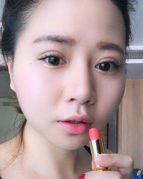 路衛(wèi)國(guó)給我做隆鼻整形后鼻子變得特別秀麗