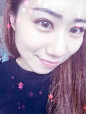 做了全切雙眼皮和開(kāi)內(nèi)眼角，術(shù)后果較為滿意