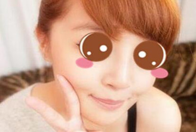 膨體隆鼻讓我的顏值更上一層