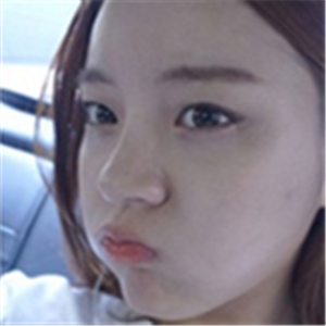 注射美白k氧注射針后一個療程的果照片，你們看前后對比，變化很大吧~